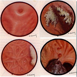 Algunas im&aacute;genes del libro "Gastritis" del Dr. Vidal Colomer